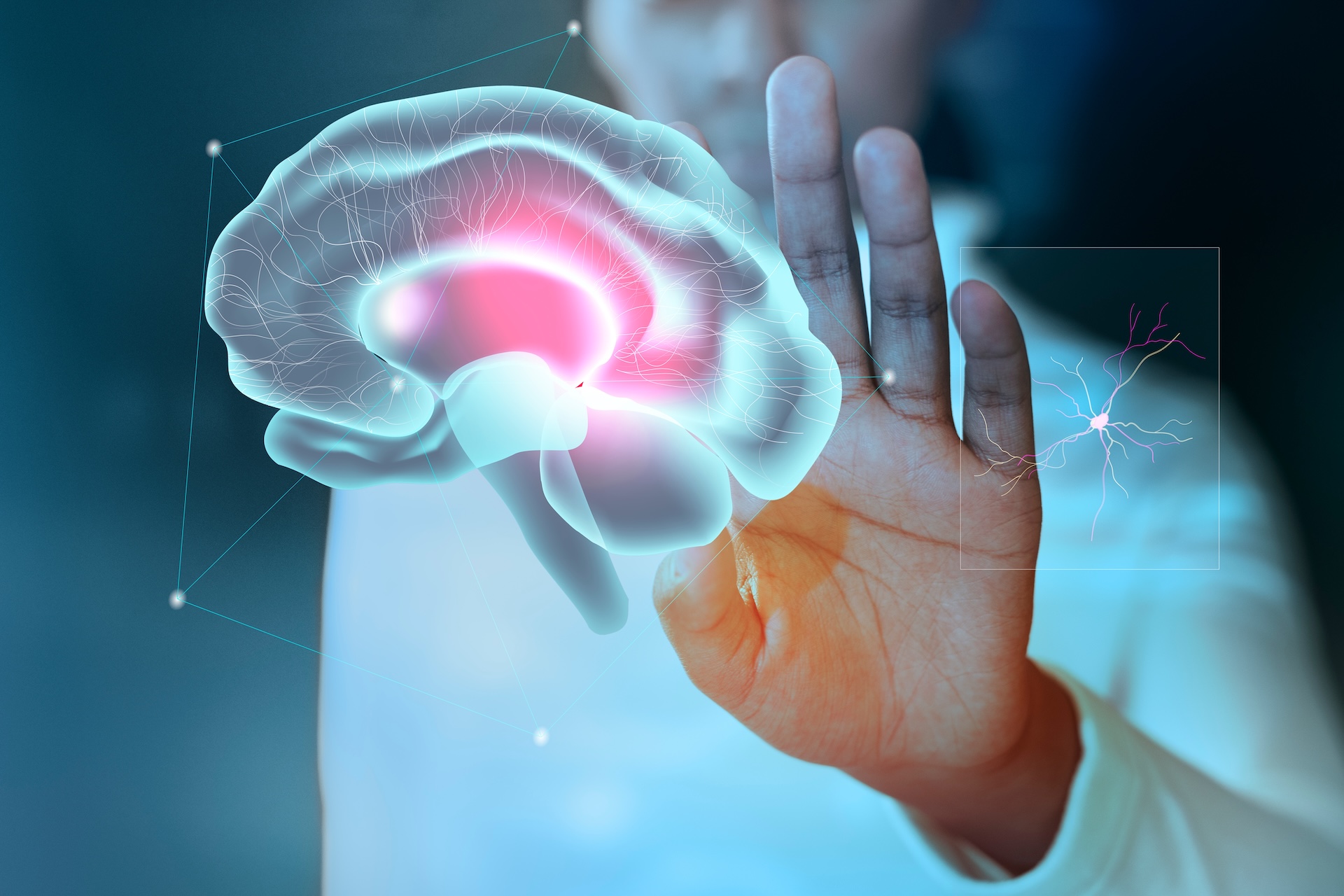 stroke recovery